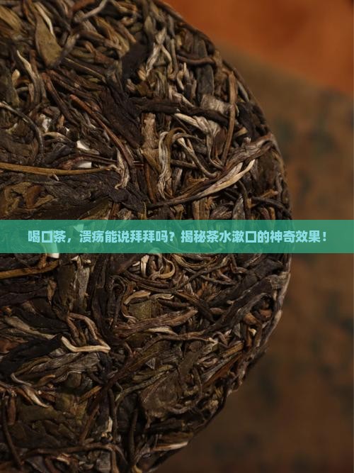 茶叶能治口腔溃疡吗
