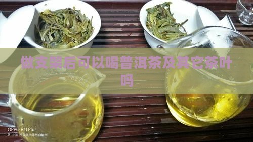 做支架后可以喝普洱茶