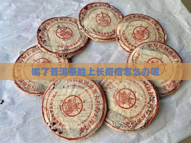 喝了普洱茶脸上长痘痘怎么办