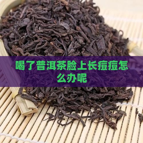 喝了普洱茶脸上长痘痘怎么办