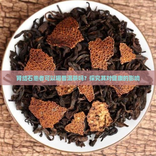 喝普洱茶对肾结石史