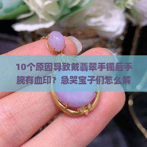 翡翠手镯怎么能带出血印