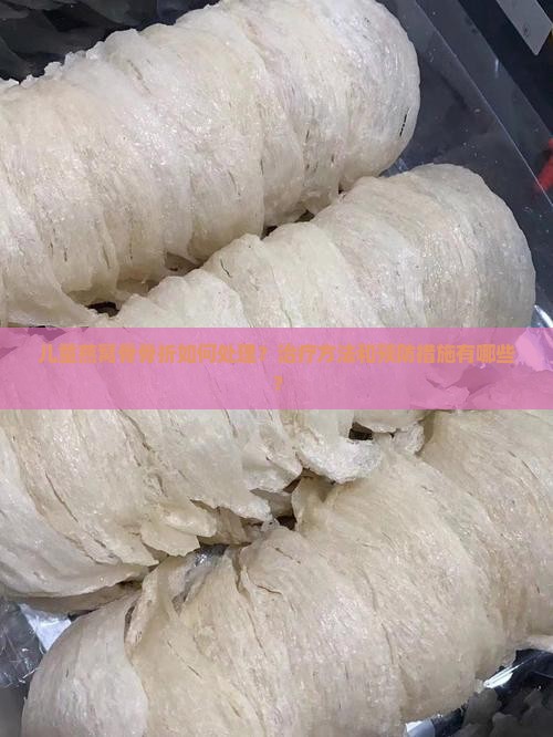 儿童燕窝骨骨折如何处理？治疗方法和预防措施有哪些？